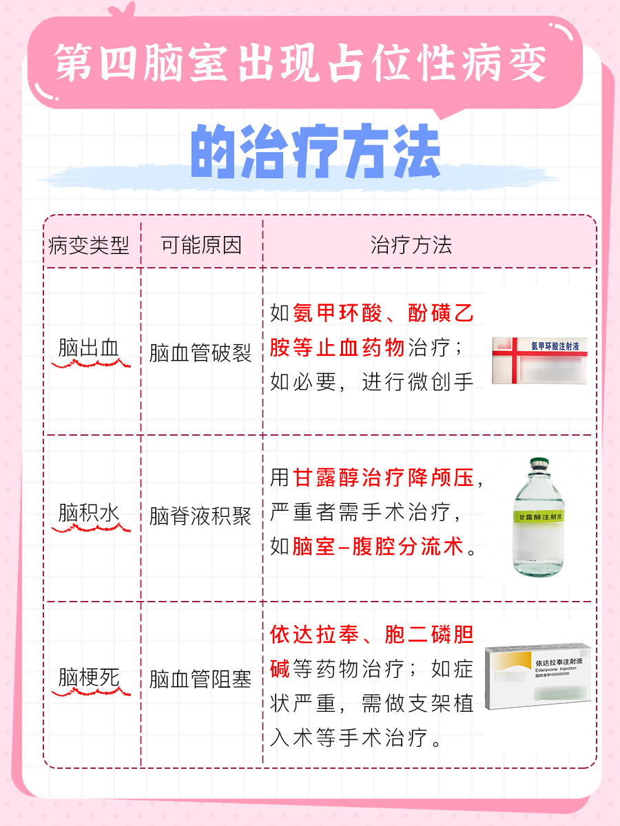 四脑室占位病变：了解可能的结果