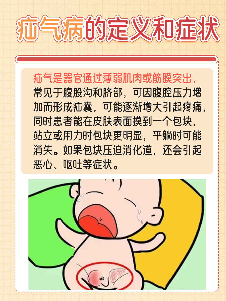 疝气病解析：什么是疝气病，有什么症状