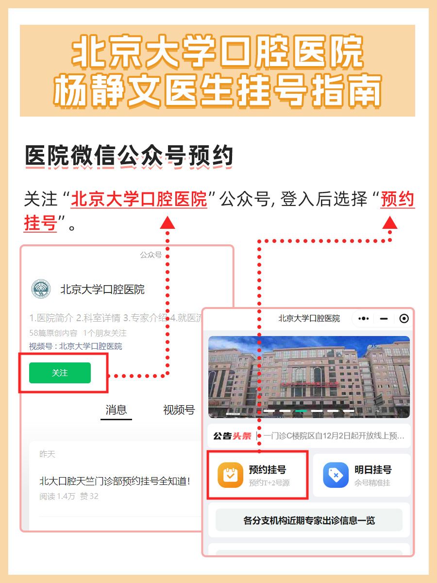 北京大学口腔医院杨静文医生怎么样？怎么挂号？