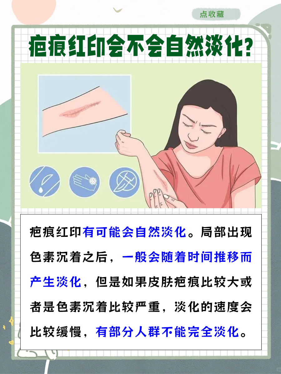 疤痕红印有没有可能会自然淡化？答案来了