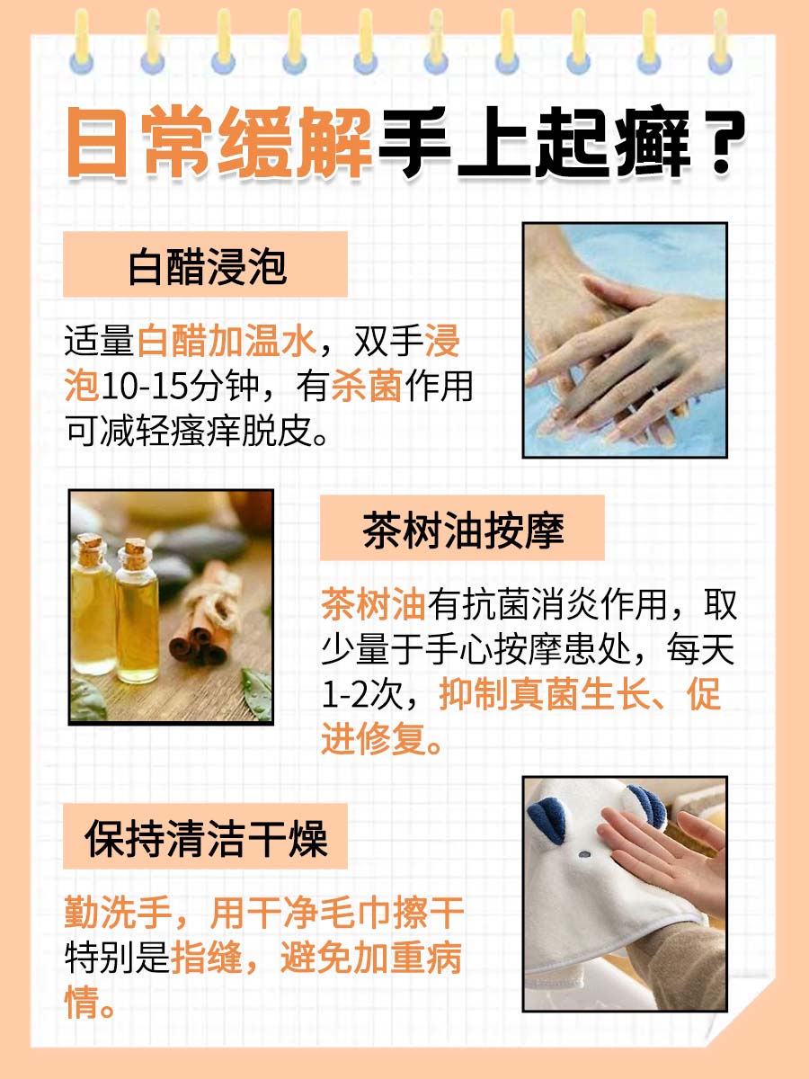 手上起癣是怎么引起的，真相大揭秘