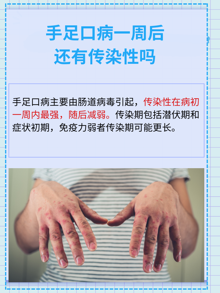 揭秘：手足口病传染性持续多久？