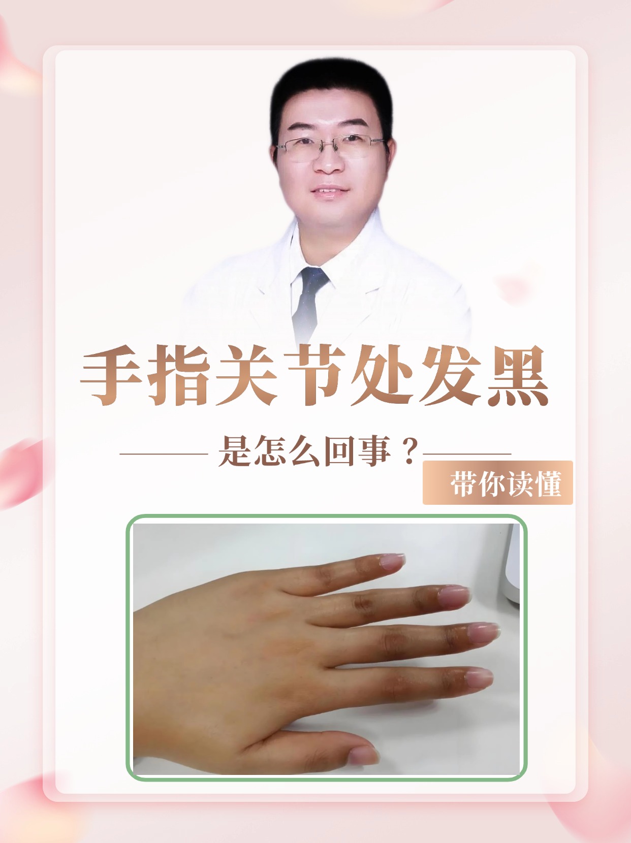 手指关节处发黑是怎么回事 ？带你读懂