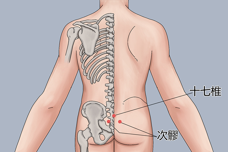 十七椎、次髎位置图 十七椎、次髎位置图