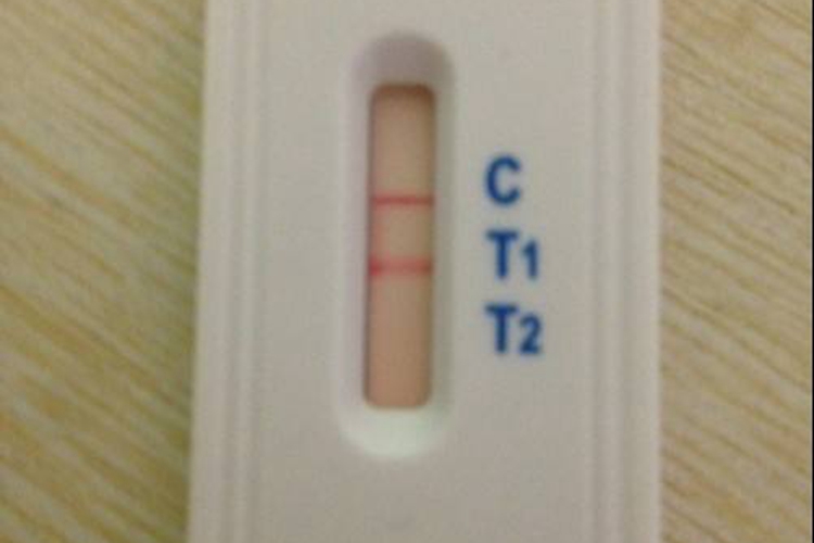 艾滋病试纸阳性图 艾滋病试纸阳性图