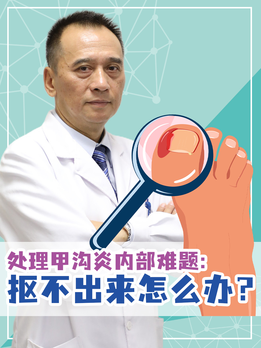 处理甲沟炎内部难题：抠不出来怎么办？