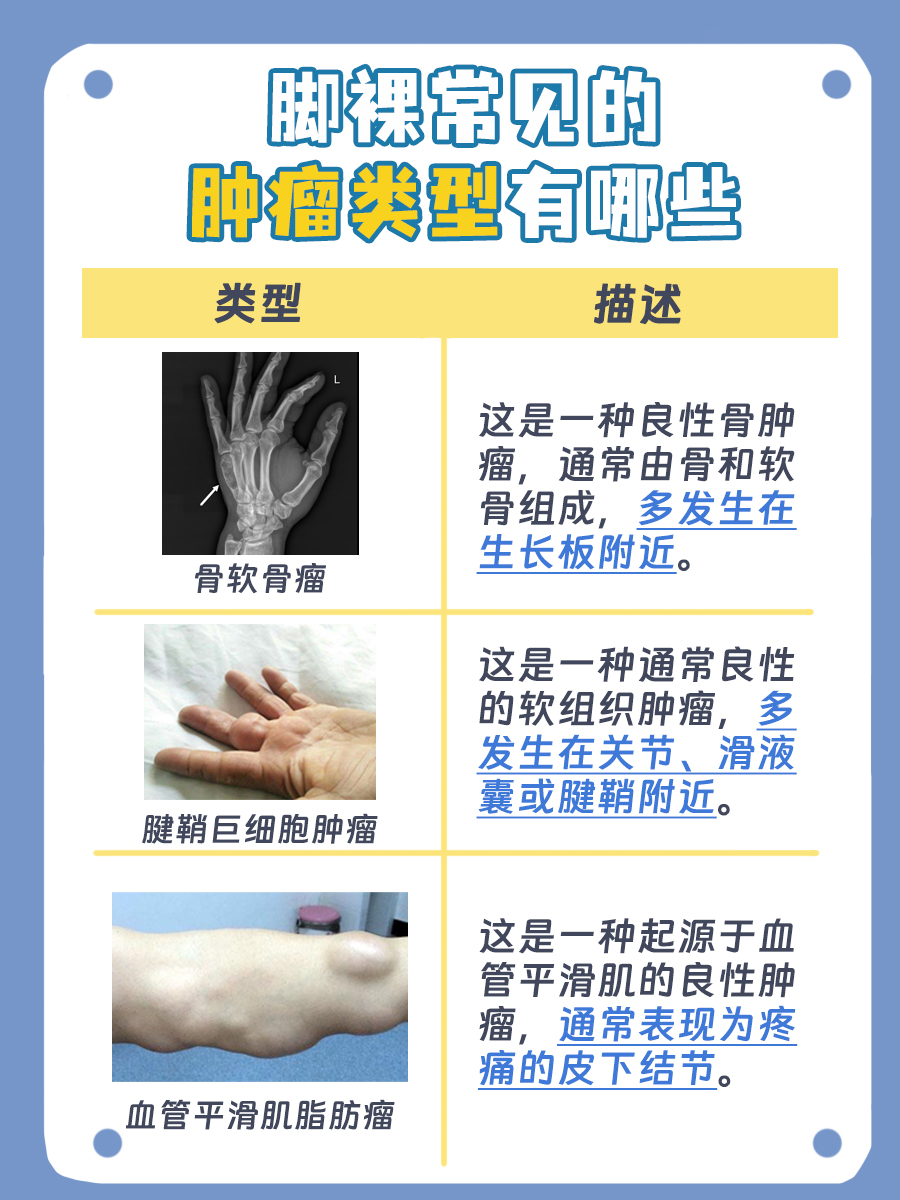 脚踝处肿瘤探秘：哪些类型最常见？