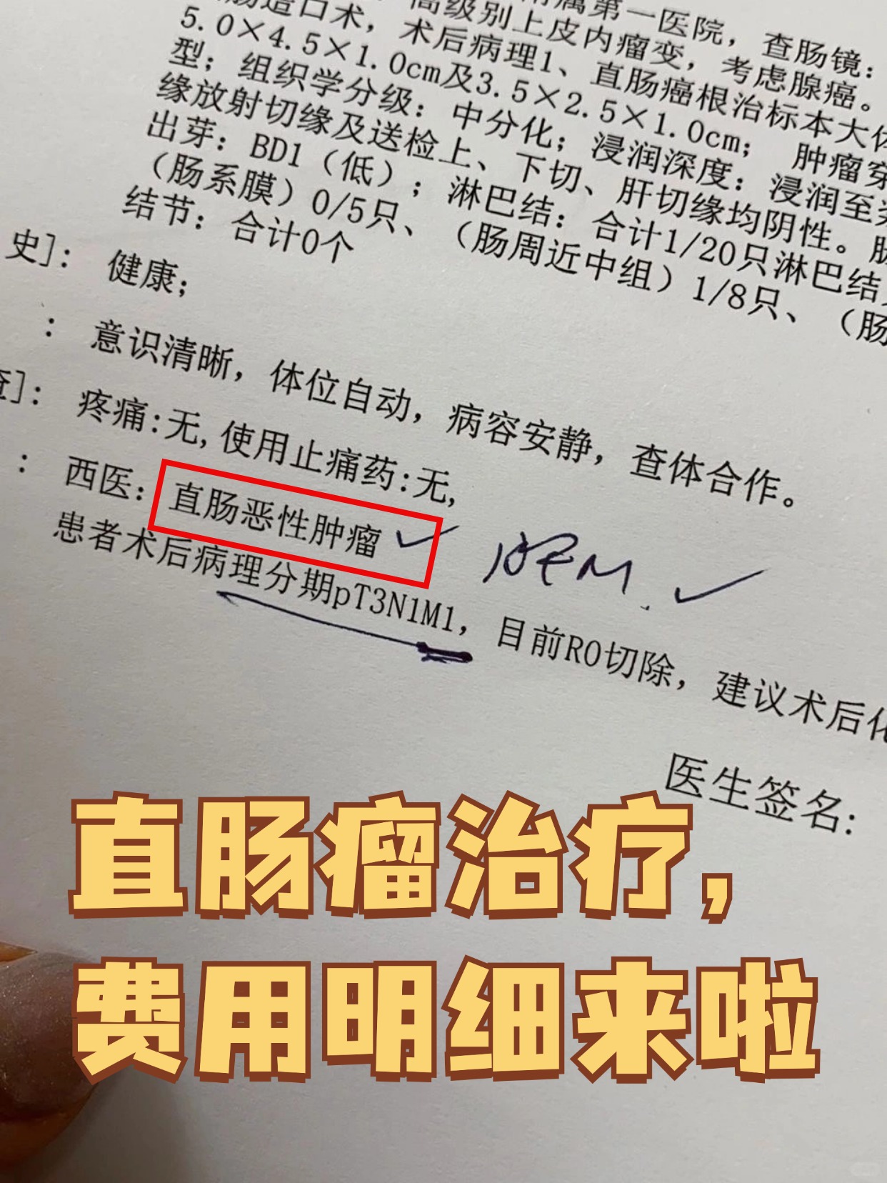 直肠瘤治疗,费用明细来啦