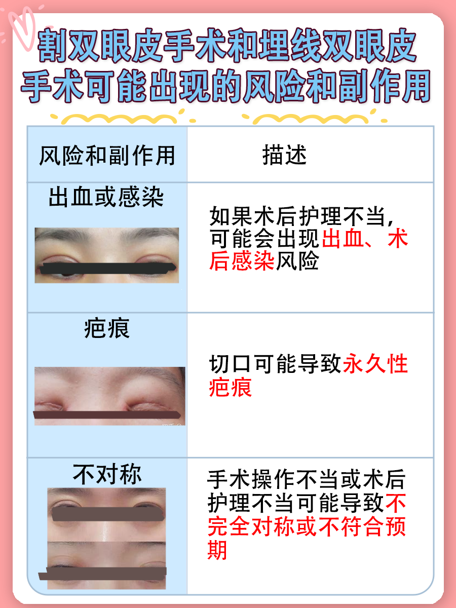 割双眼皮VS埋线，哪个好一点，专家解析！