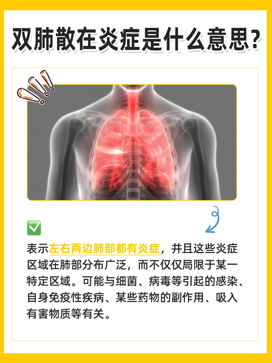 医生解读：双肺散在炎症究竟是什么意思？