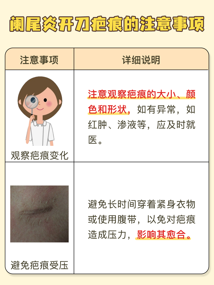 阑尾炎手术后疤痕位置指南：究竟在哪里