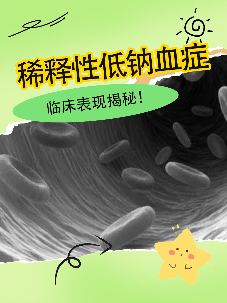 稀释性低钠血症，临床表现揭秘！