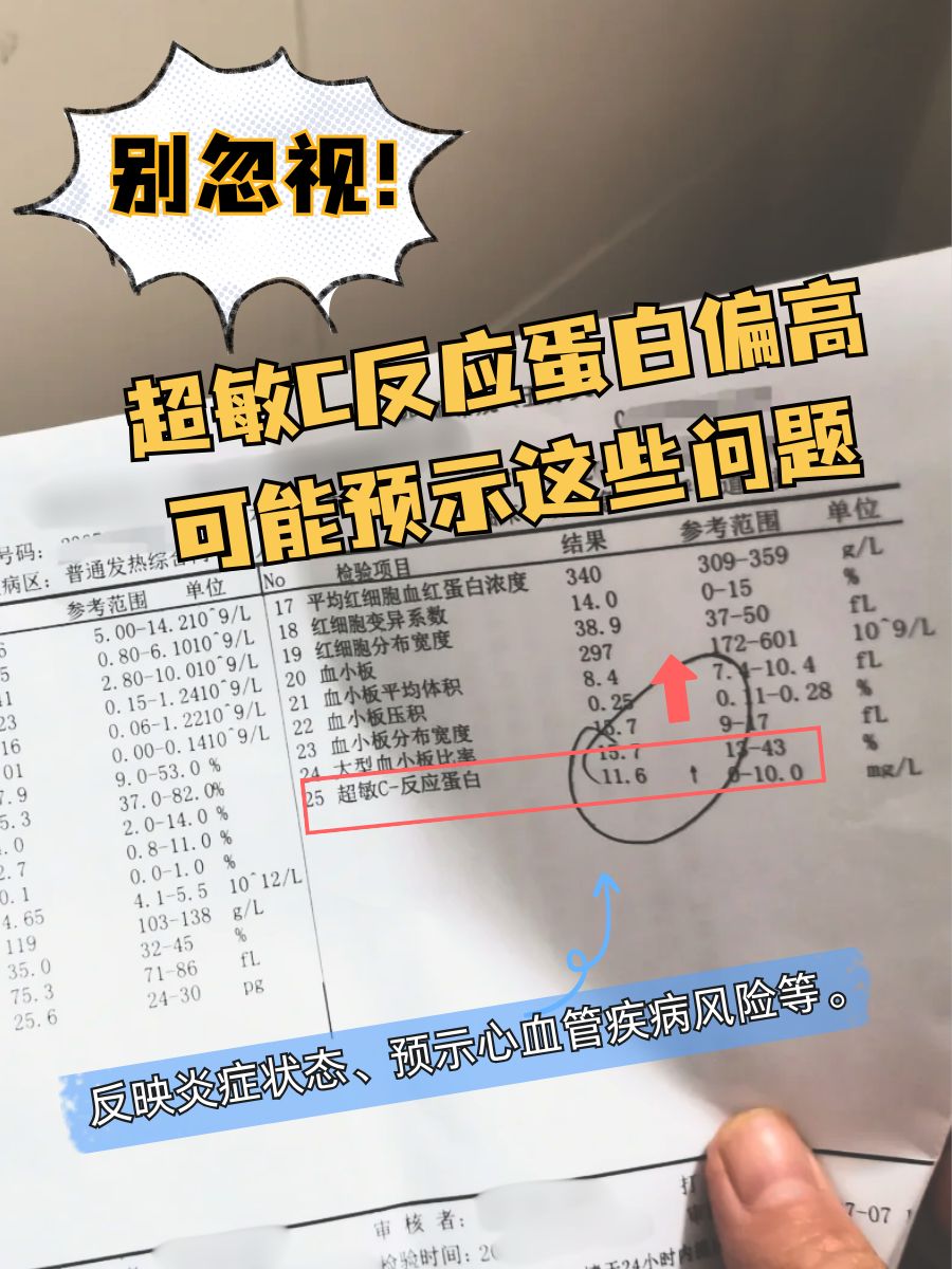 别忽视!超敏C反应蛋白偏高可能预示这些问题