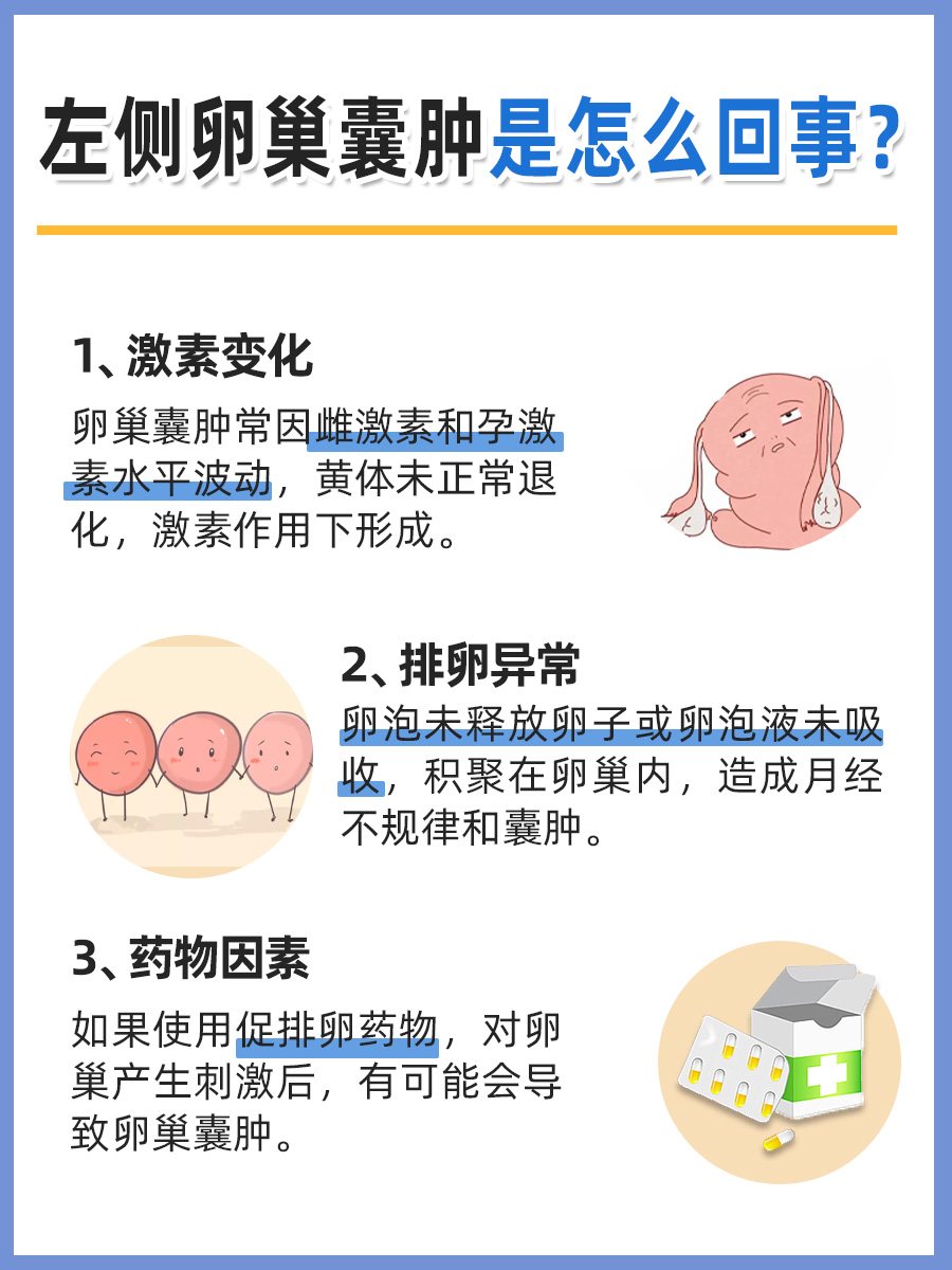 左侧卵巢囊肿,究竟何因?