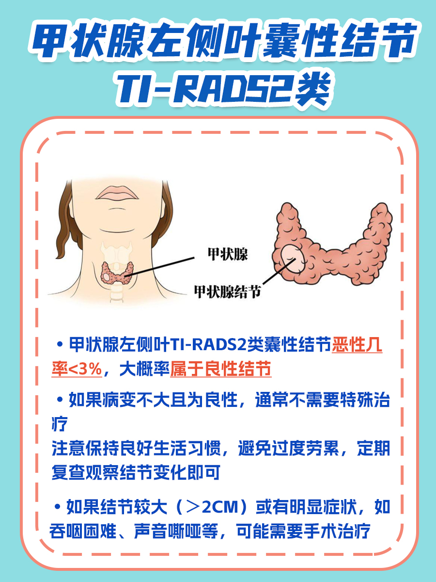 了解：甲状腺左侧叶囊性结节TI-RADS2类