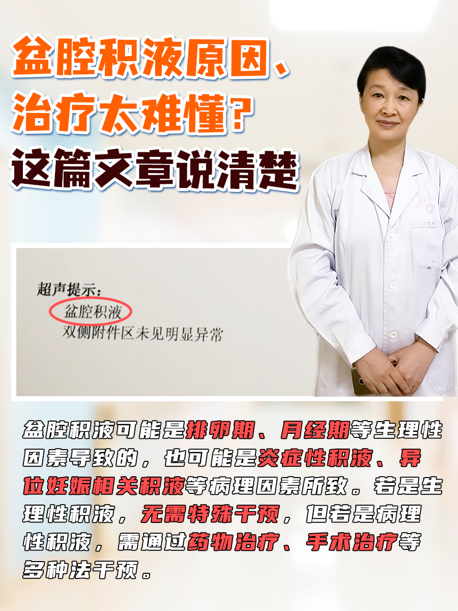 盆腔积液原因、治疗太难懂?这篇文章说清楚