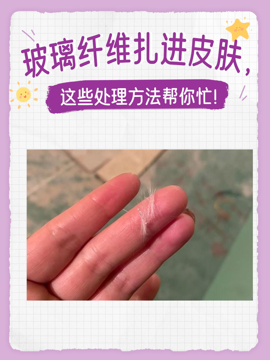 玻璃纤维扎进皮肤，这些处理方法帮你忙！