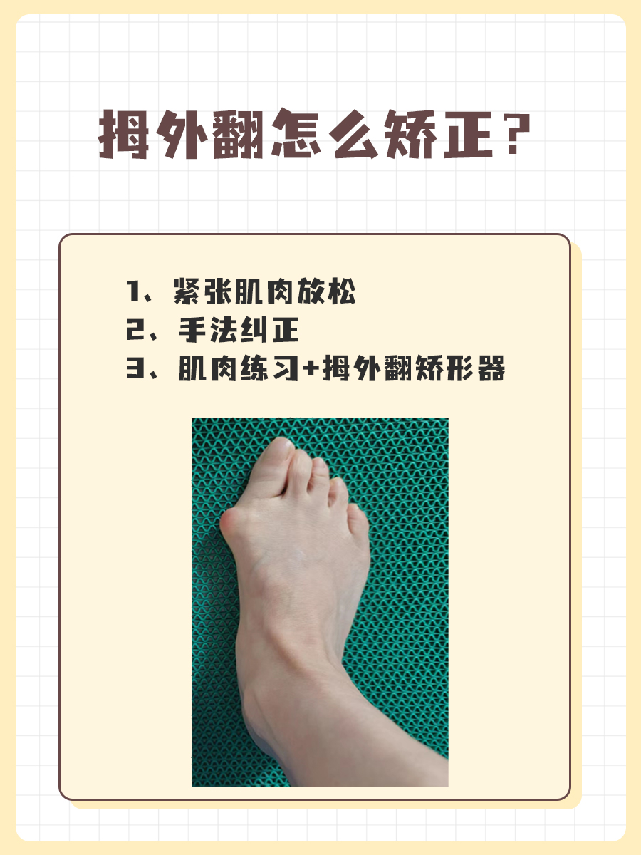 拇外翻怎么矫正?医生分享3个方法!
