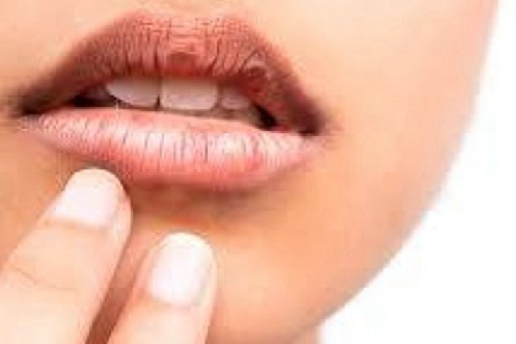 干燥综合征嘴唇纹路加深图