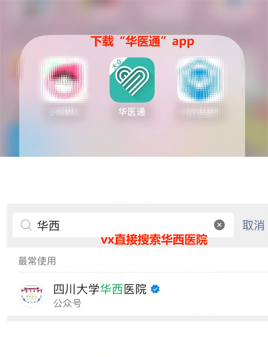 华西医院梁传余医生怎么样?怎么挂号?