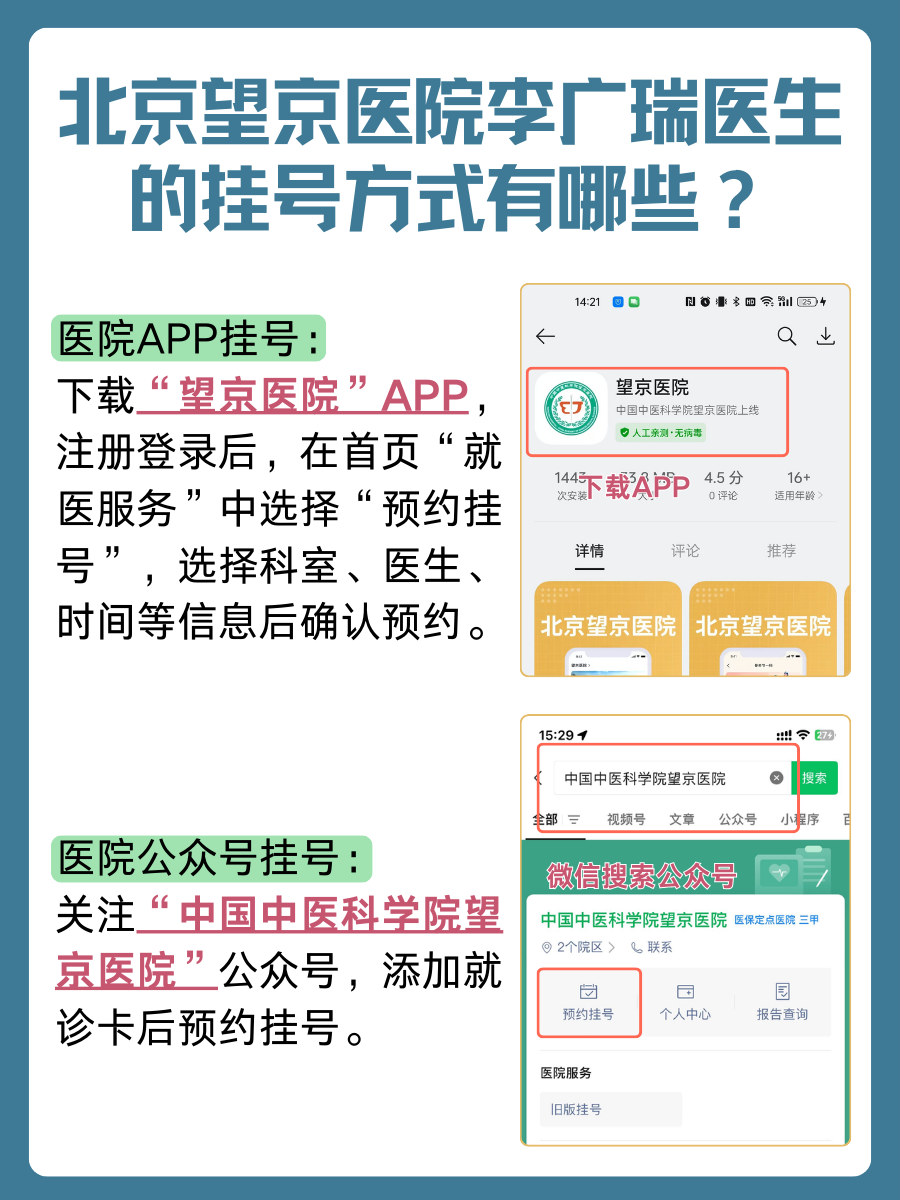 北京望京医院李广瑞医生怎么样？怎么挂号？