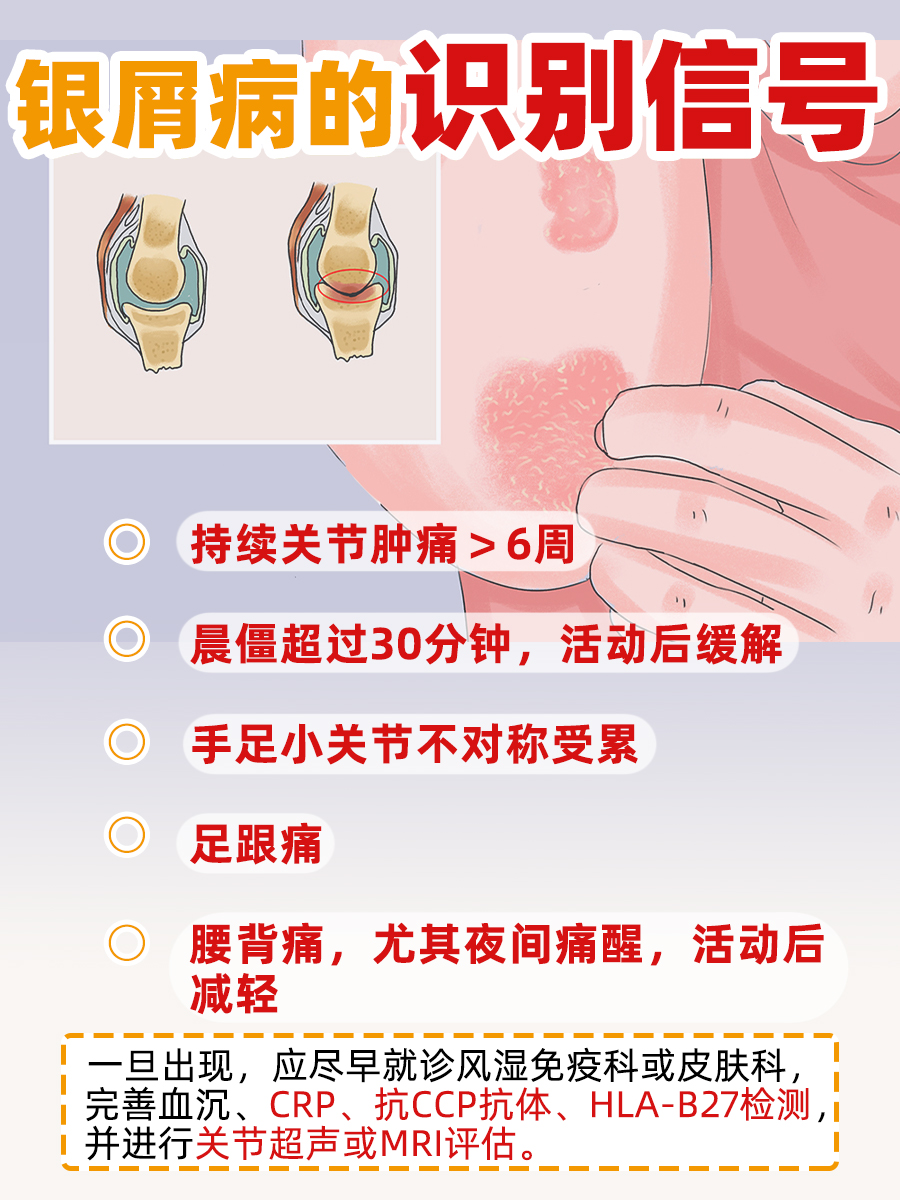 银屑病风湿性关节炎怎么引起的，一篇讲清楚