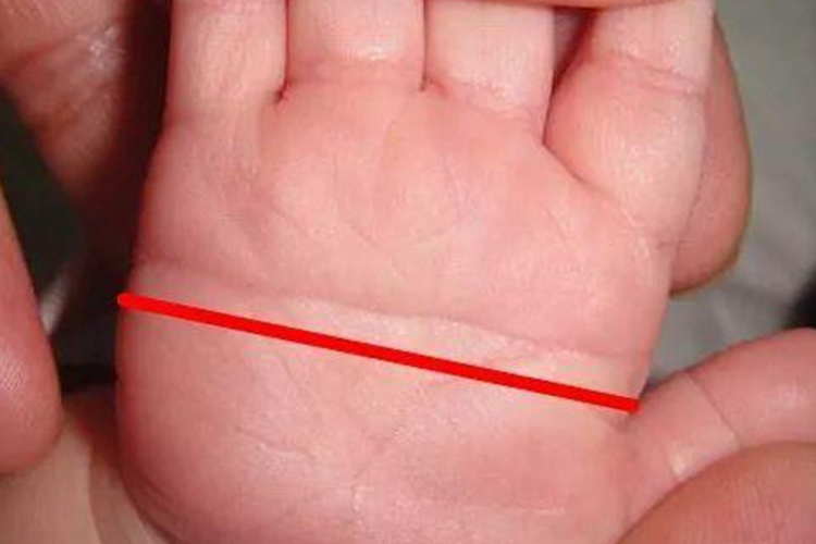 唐氏儿通贯掌图 唐氏儿通贯掌图