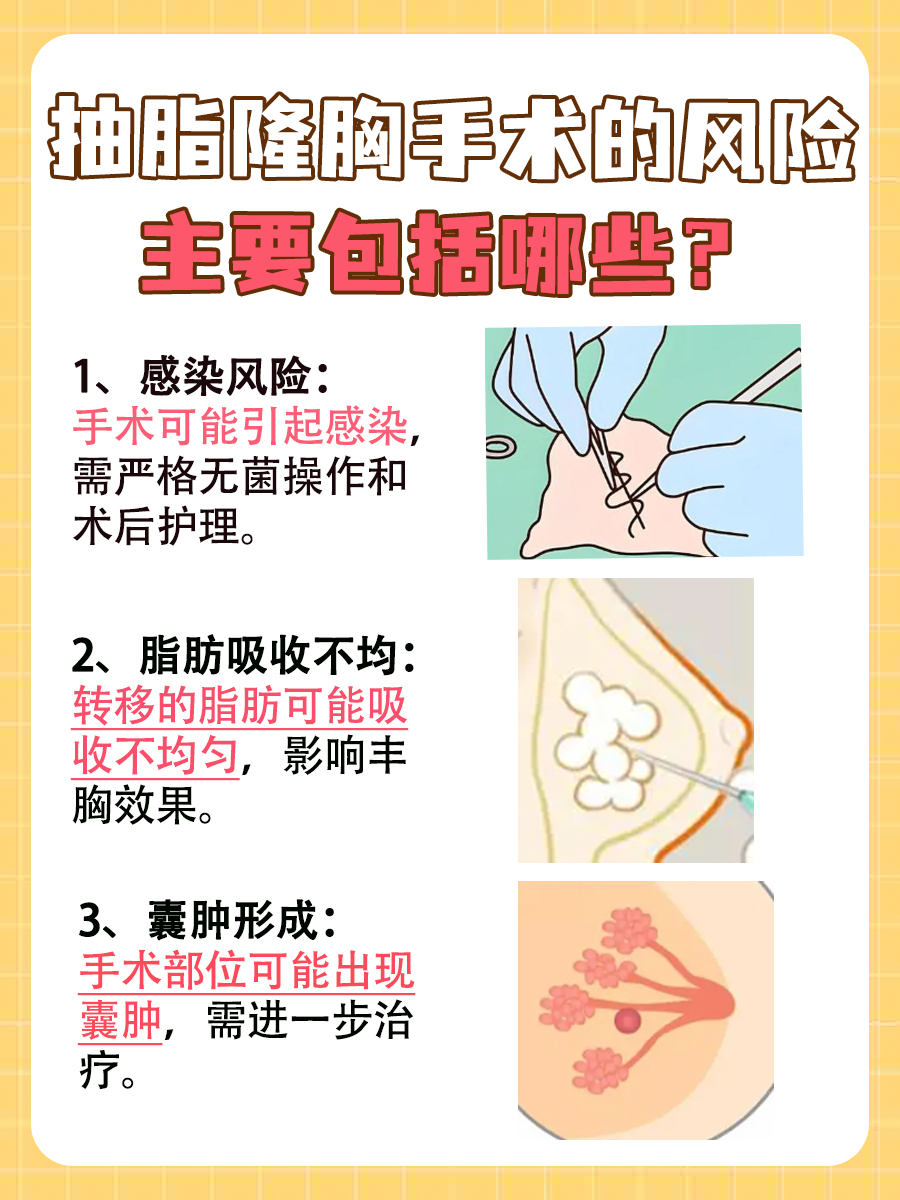 抽脂隆胸安全么,这里有答案!