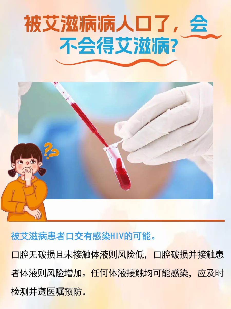 被艾滋病病人口了会得艾滋病吗？医生解读