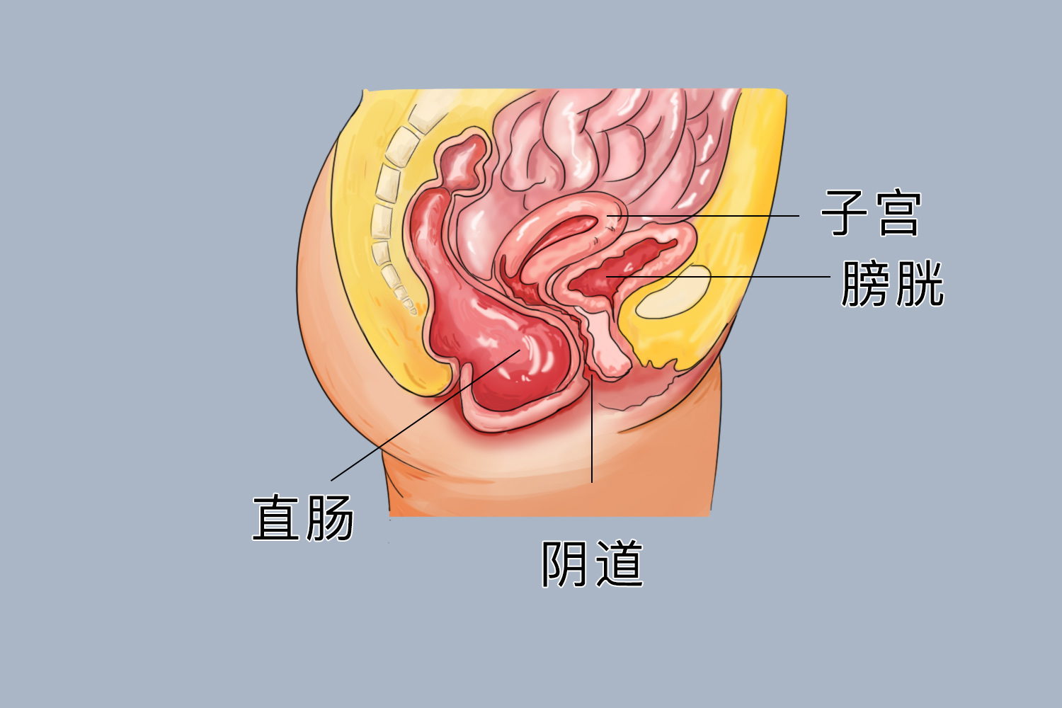阴道后壁（直肠）膨出图