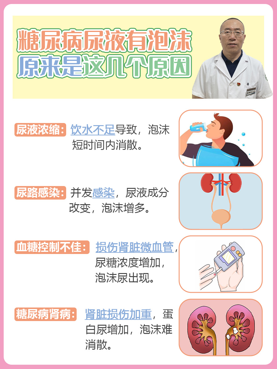 糖尿病尿液有泡沫 ，原来是这几个原因