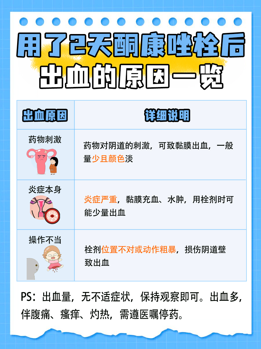 用了2天酮康唑栓有出血，咋回事？要停药吗？