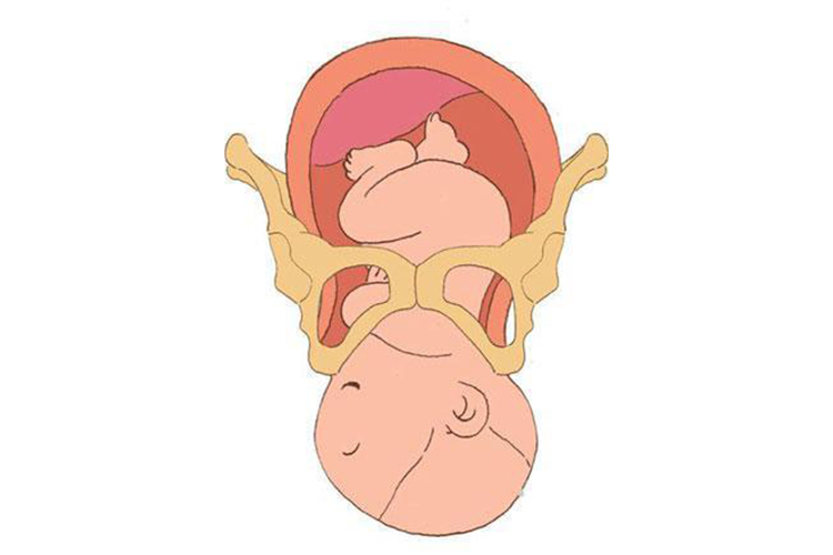 骨产道图 骨产道图