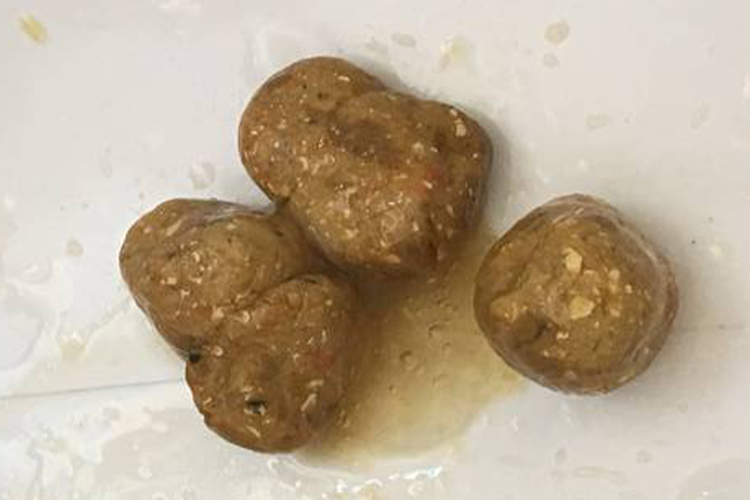 便秘大便干硬图 便秘大便干硬图