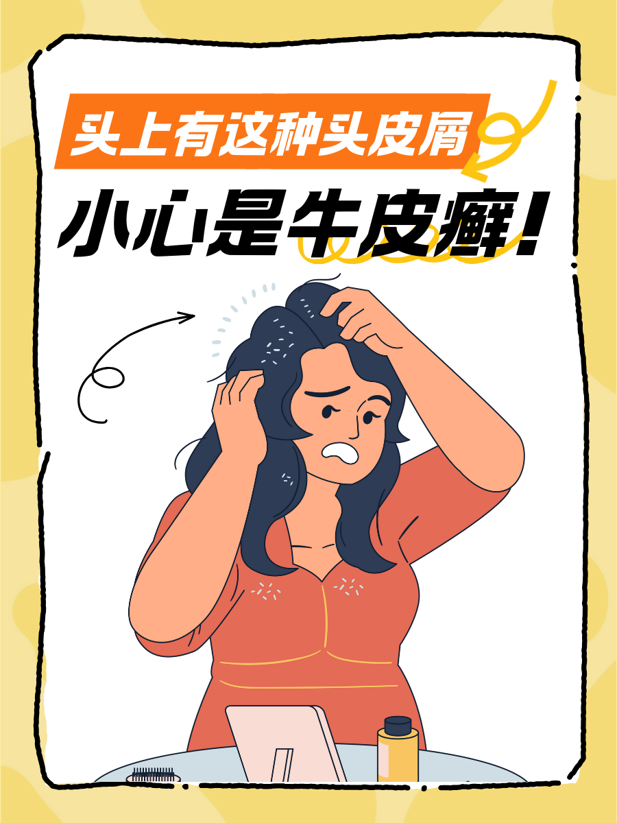 牛皮癣头皮屑，一篇说清自救指南