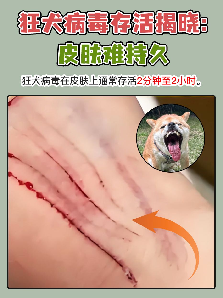 狂犬病毒存活揭晓：皮肤难持久