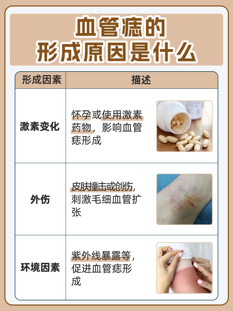 血管痣：对身体是否有潜在危害？