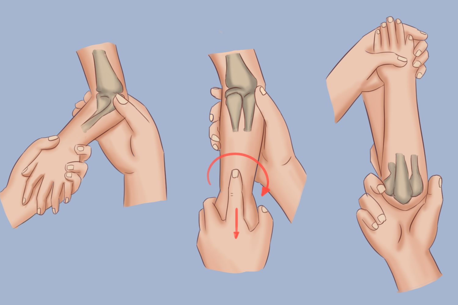 桡骨小头半脱位手法复位图