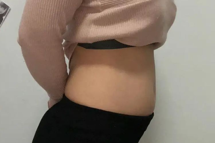 妊娠3个月显怀图