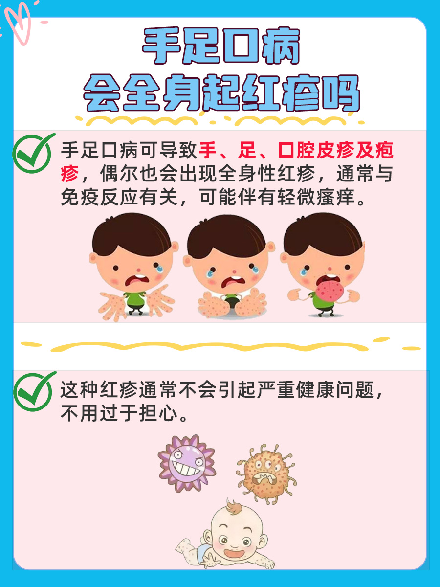 手足口病不止手和脚:探究全身红疹的真相