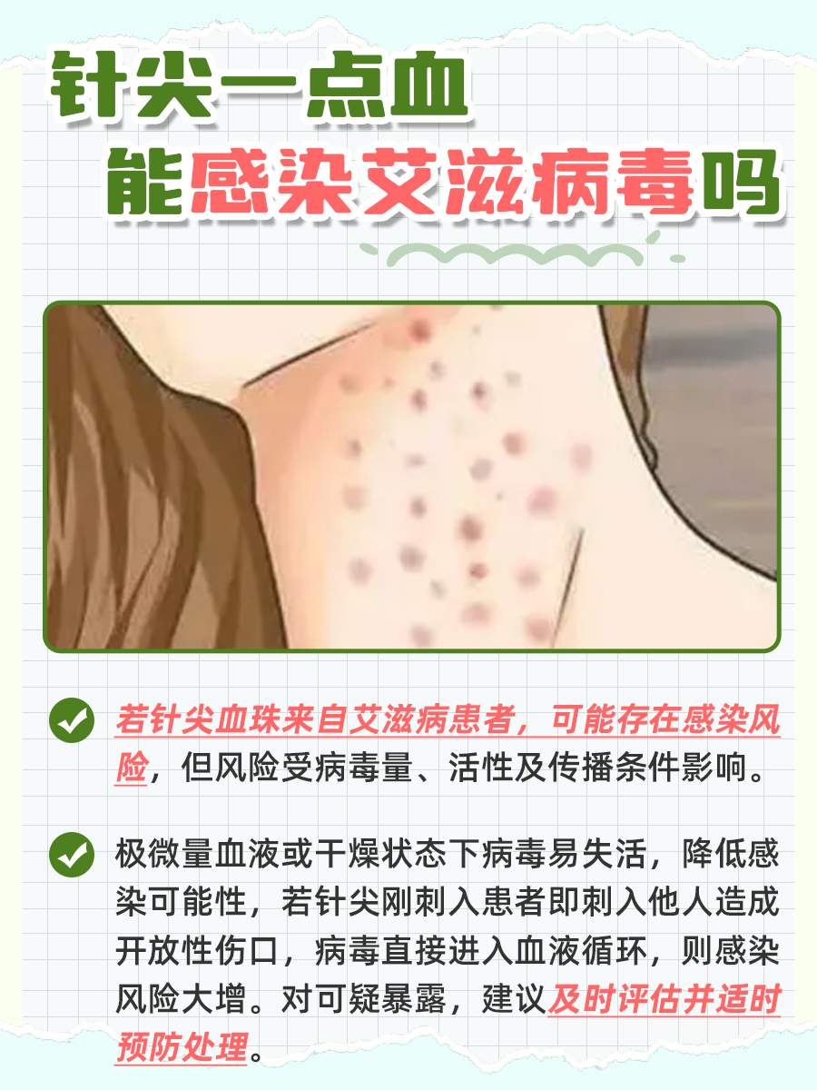 揭秘！针尖上的血珠能否传递艾滋病毒？