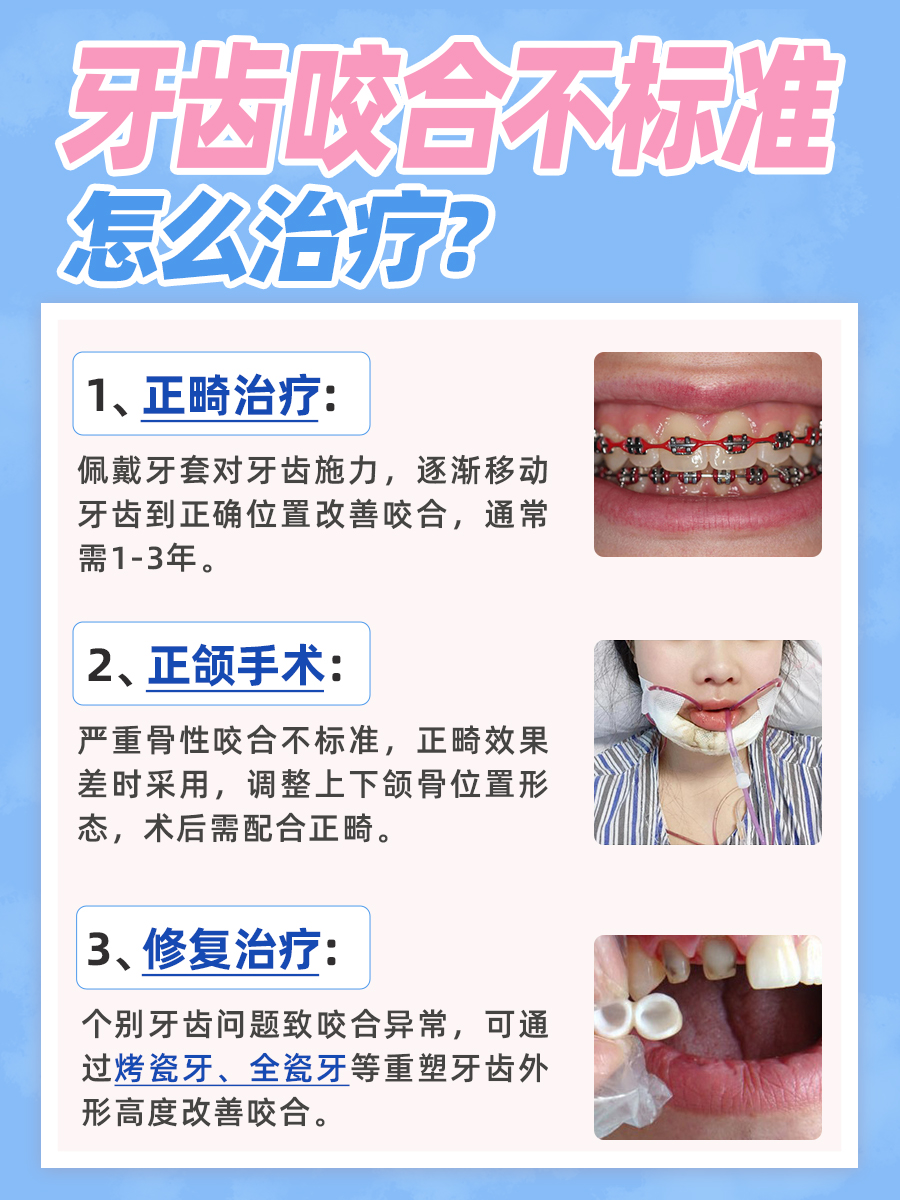 标准的牙齿咬合图