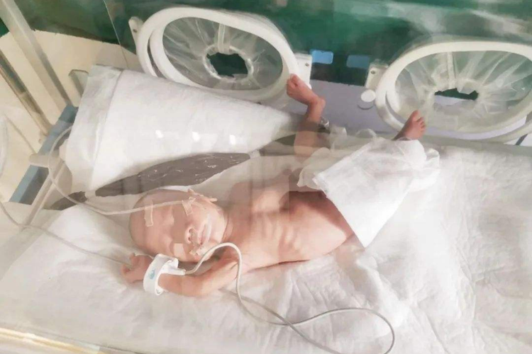 婴儿得肺炎胸口凹陷图 婴儿得肺炎胸口凹陷图