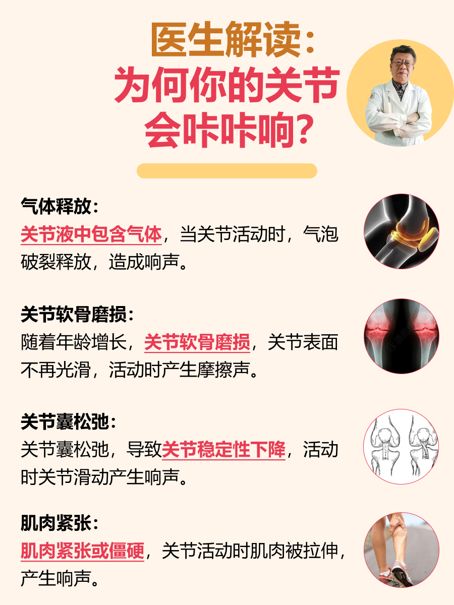 医生解读:为何你的关节会咔咔响?