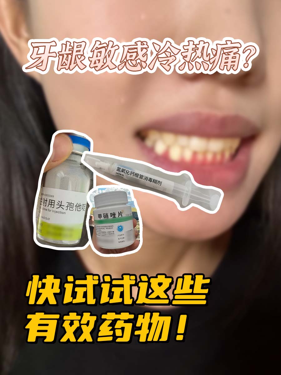 牙龈敏感冷热痛？快试试这些有效药物！