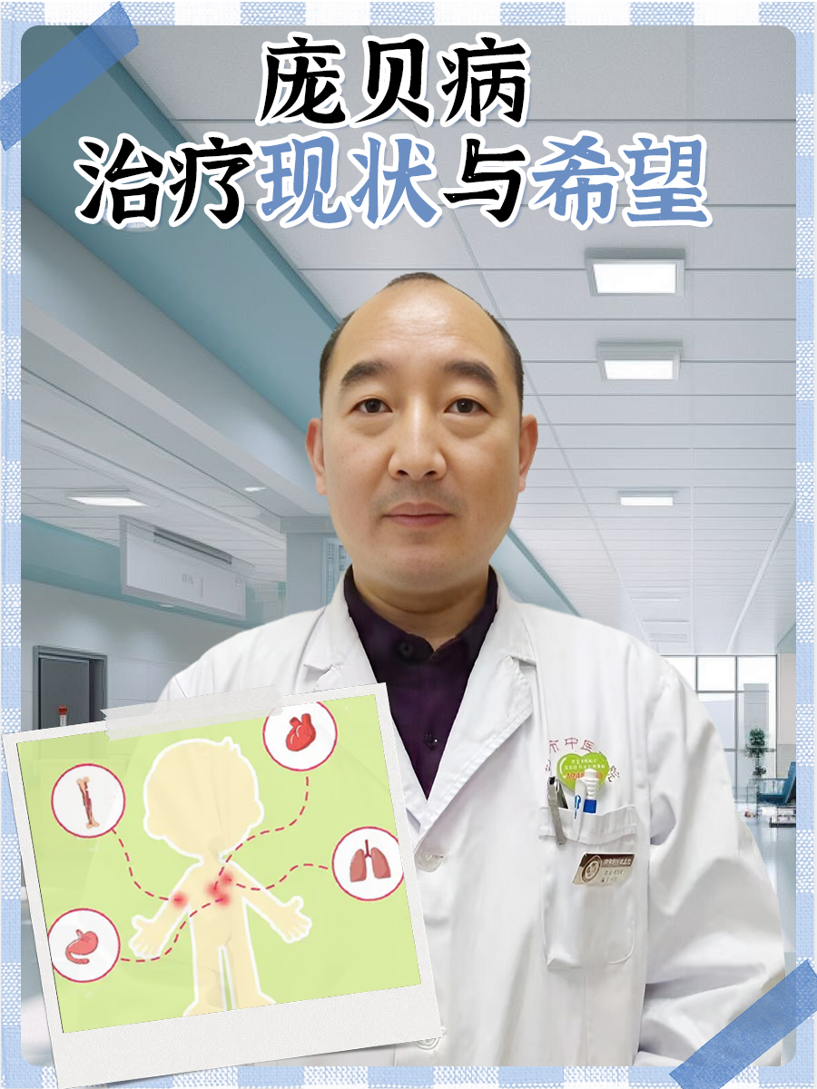 庞贝病：治疗现状与希望