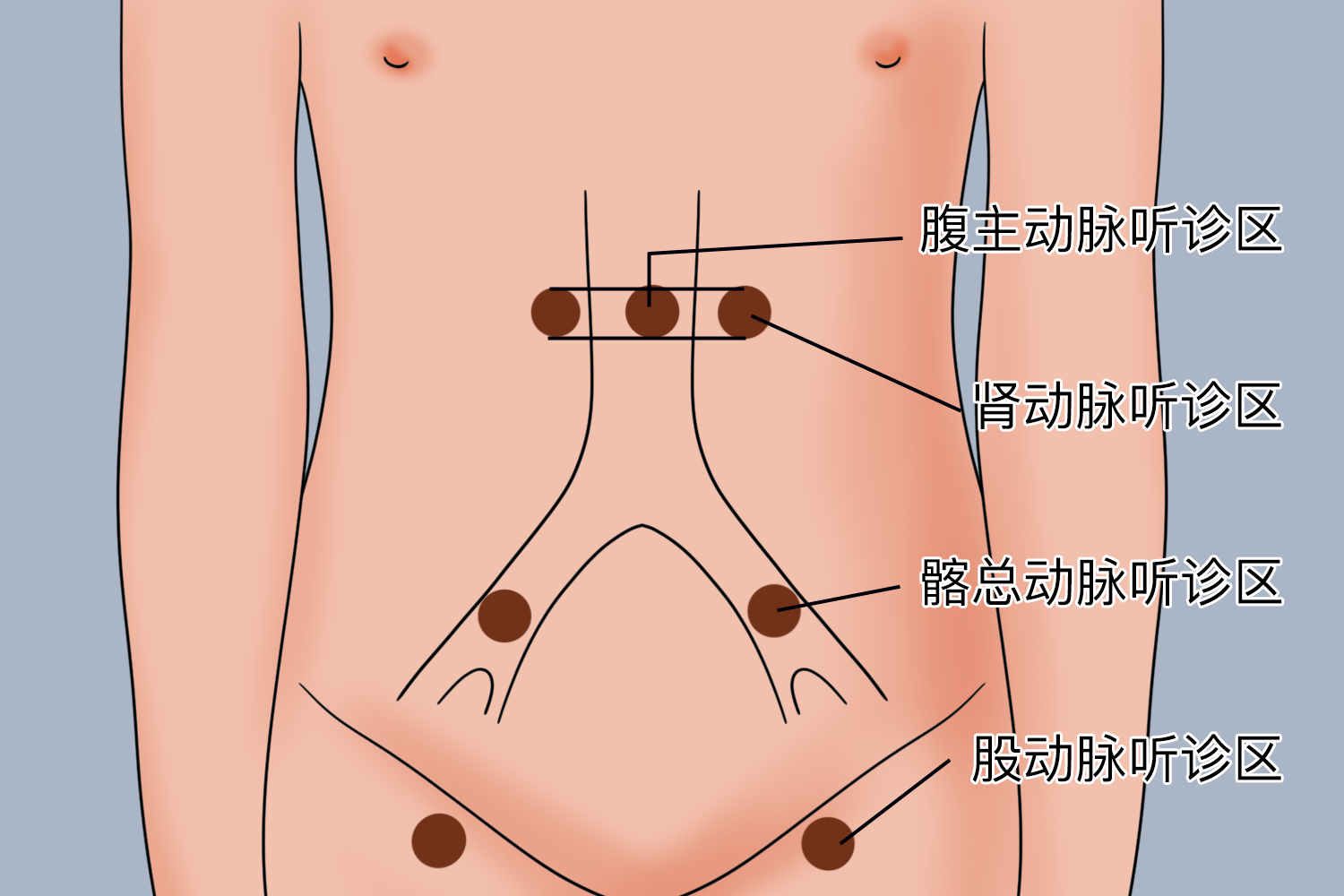 腹部血管听诊部位图