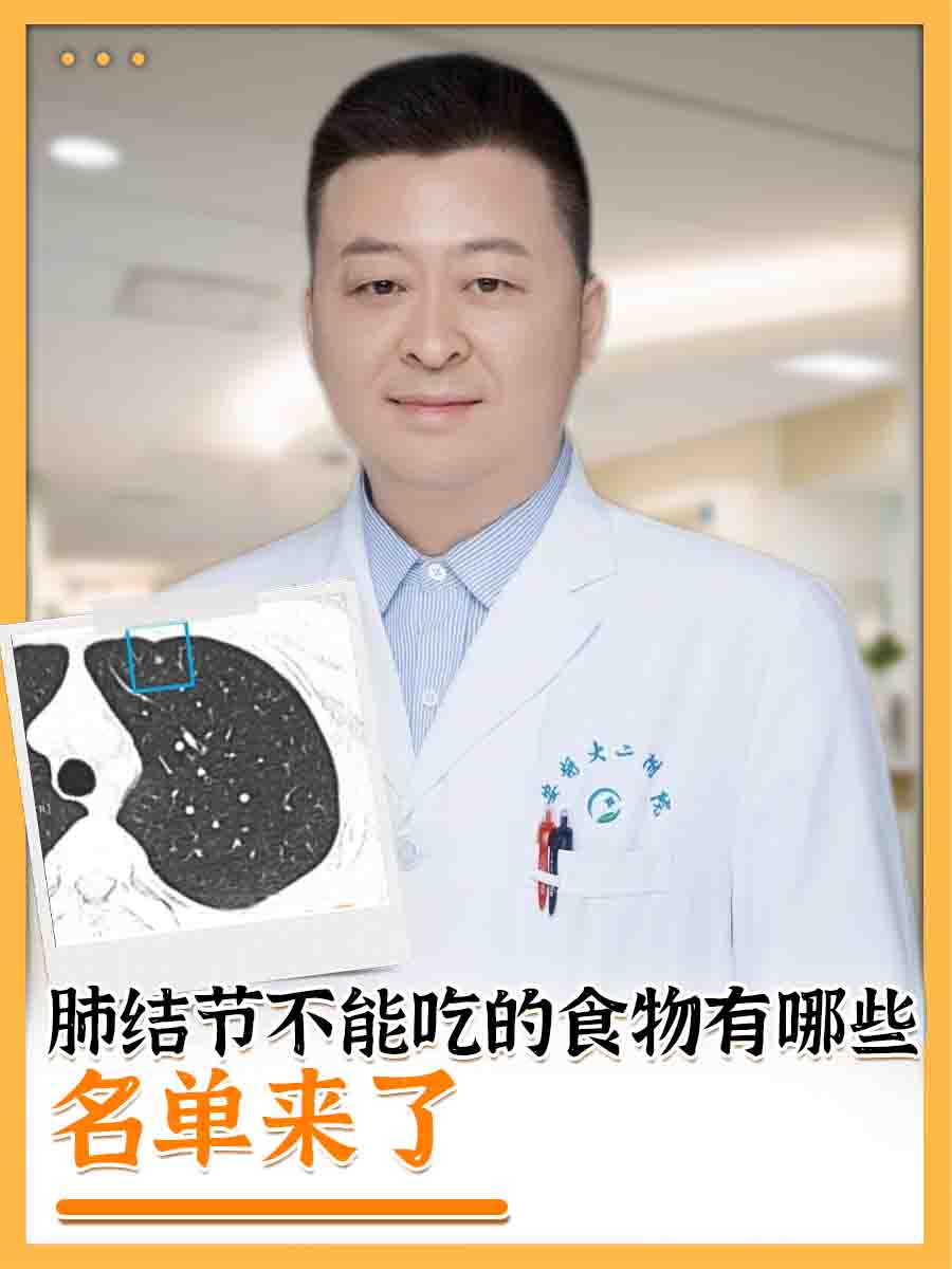 肺结节不能吃的食物有哪些，名单来了