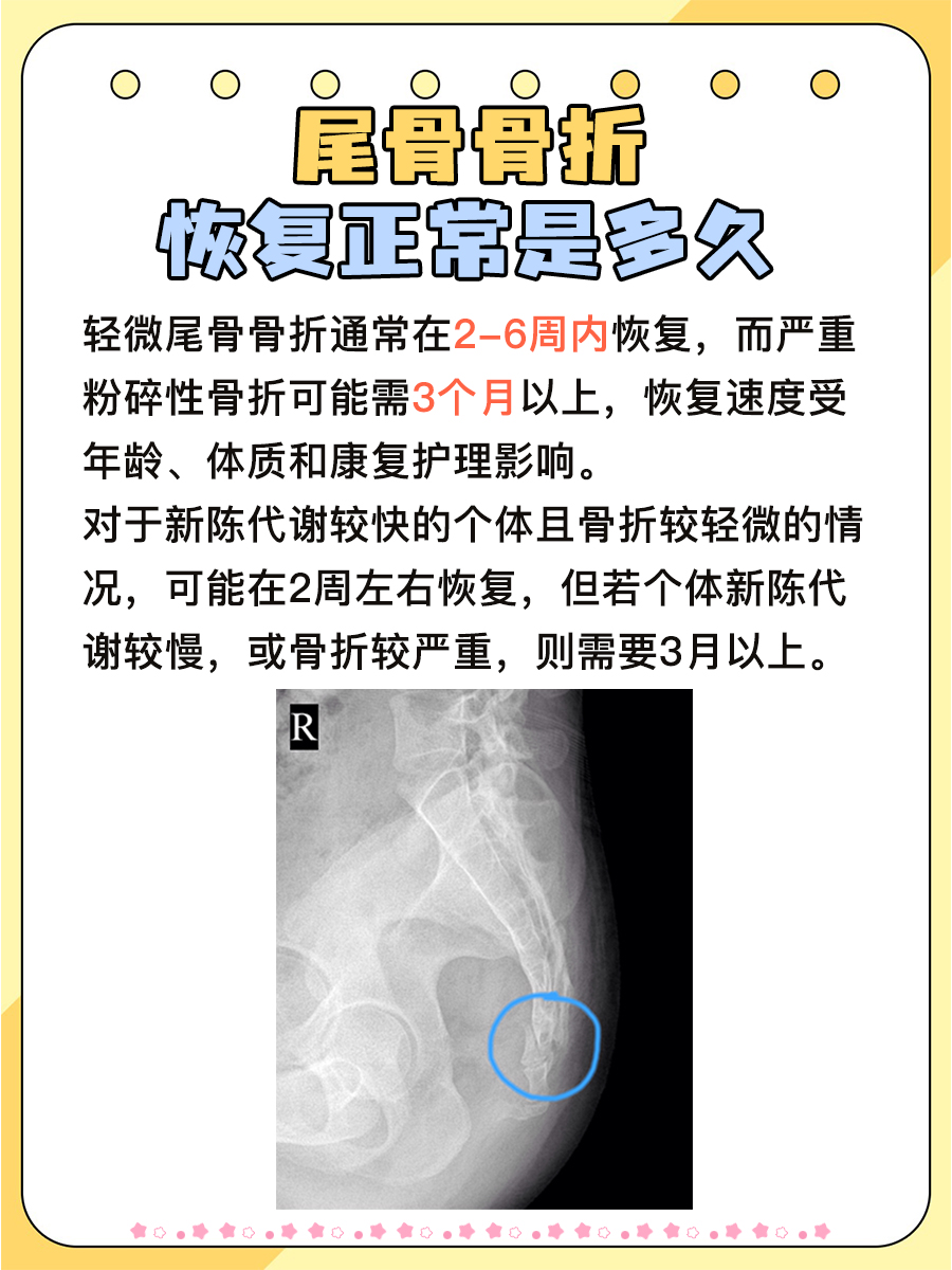 一文解析尾骨骨折恢复时间：从治疗到痊愈