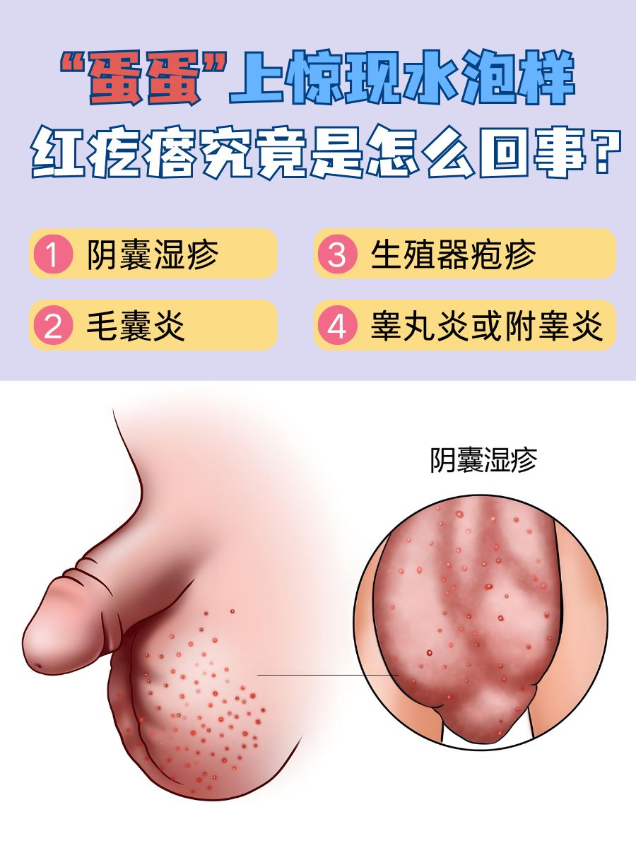 “蛋蛋”上惊现水泡样红疙瘩，究竟是怎么回事？